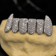 Close Up Iced Out VVS Moissanite Stone Setting on Custom Grillz